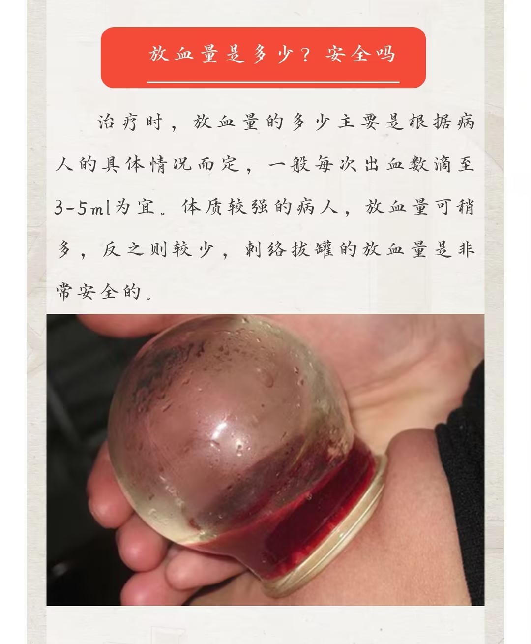 94e5a19d99c9b4f9d69216f841e7e1a8.jpg 94e5a19d99c9b4f9d69216f841e7e1a8.jpg